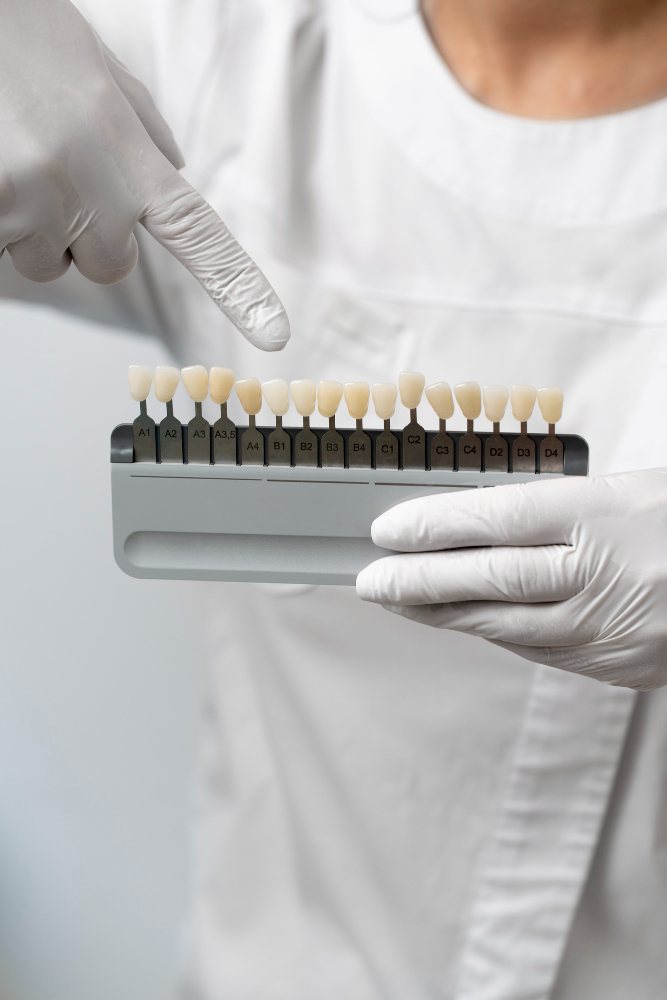 Facetas de Porcelana em Cuiabá